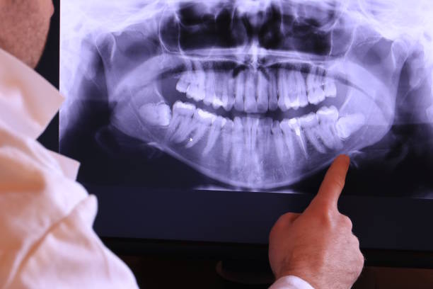 Best Broken or Cracked Tooth Emergency Dentist in Naugatuck, CT