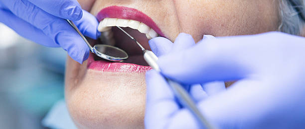 Best Emergency Dental Care for Abscessed Tooth in Naugatuck, CT
